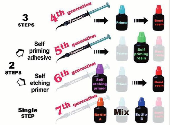 Generations of Composite Bonding Agents