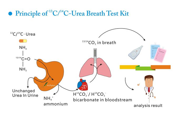 Urea Breath Test