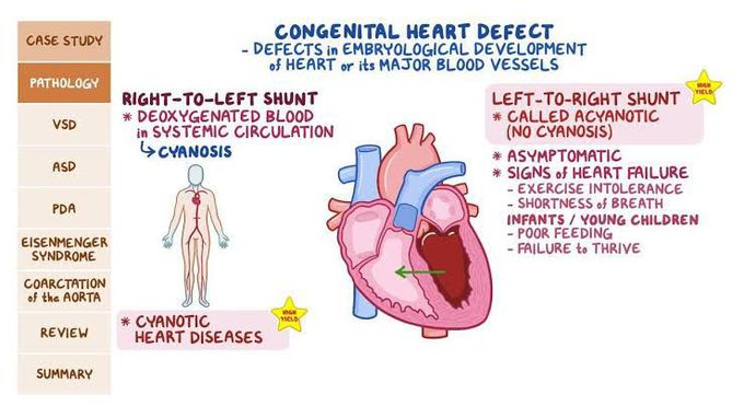 Cyanotic heart disease