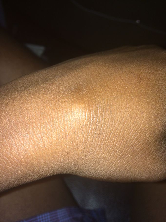 Diagnosis pls