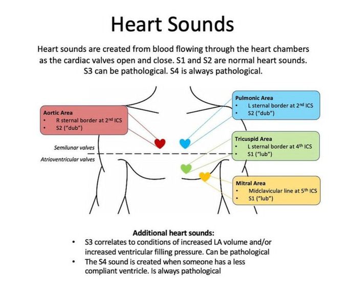 Heart Sounds