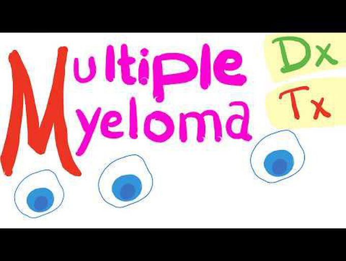 Multiple Myeloma Diagnosis and Treatment