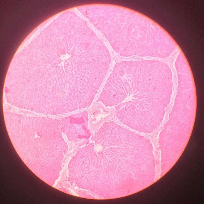liver