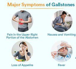 Symptoms of Cholelithiasis - MEDizzy