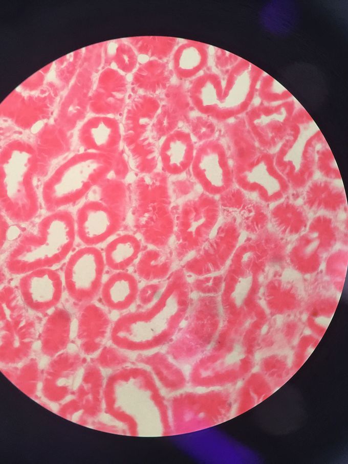 Kidney