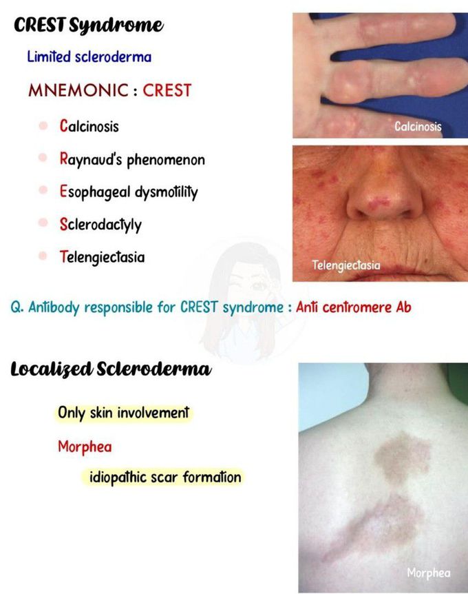 Scleroderma III