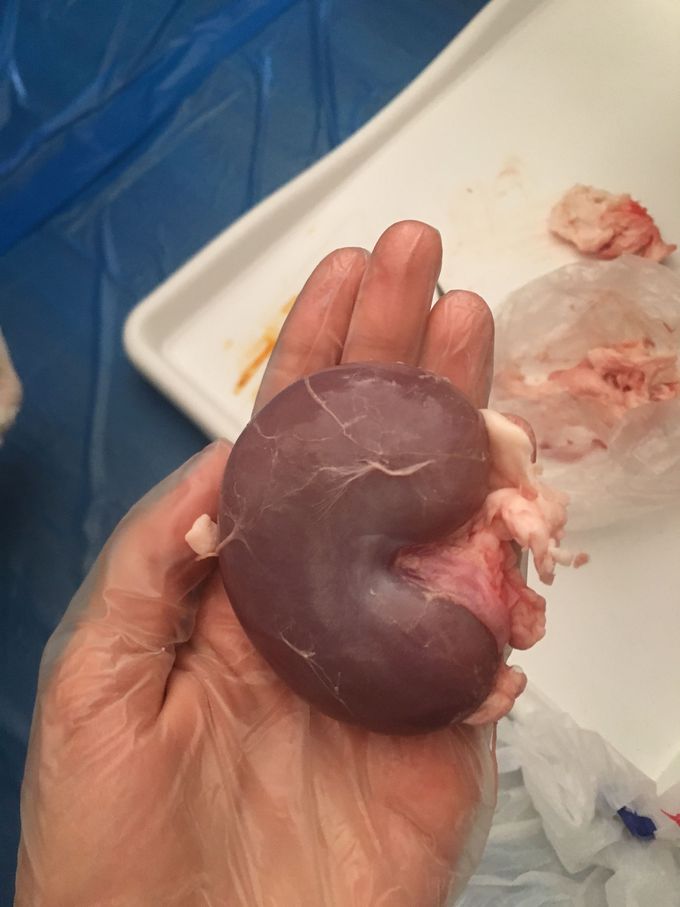 Kidney