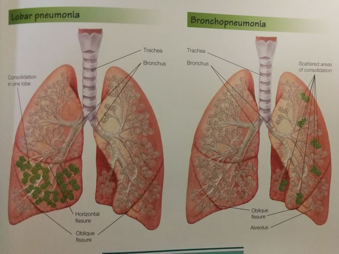 lung parenchyma anatomy