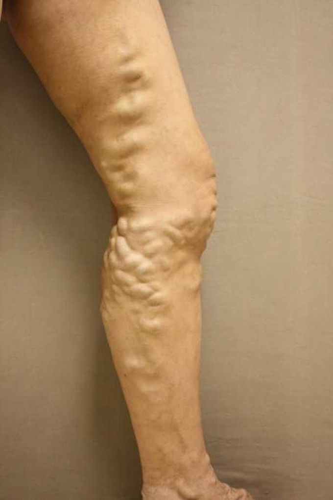 What is your Diagnosis?