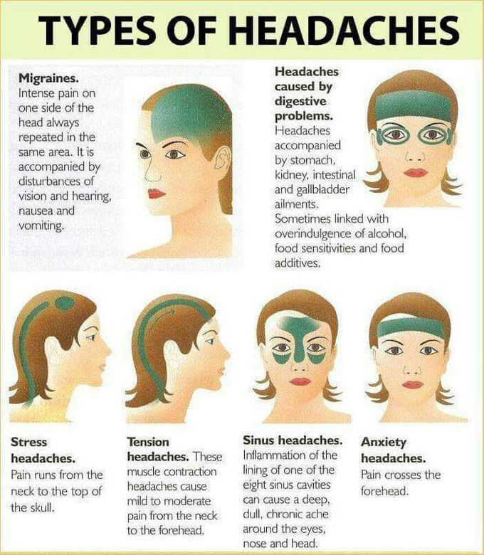 Types of headaches
