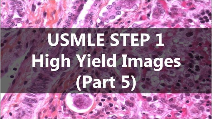 USMLE STEP 1 High Yield Images (Part 5)