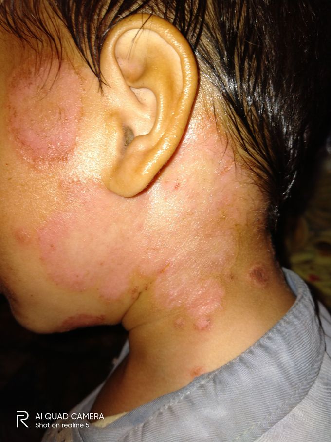 Diagnose please..
