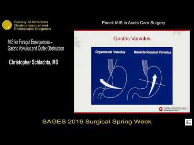 Gastric volvulus