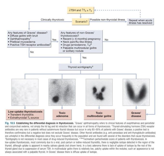 Hyperthyroidism IV