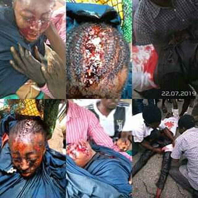 Missed AK47 bullet