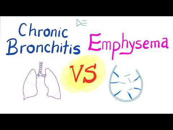 Chronic Bronchitis VS Emphysema | Comparison | Pulmonology