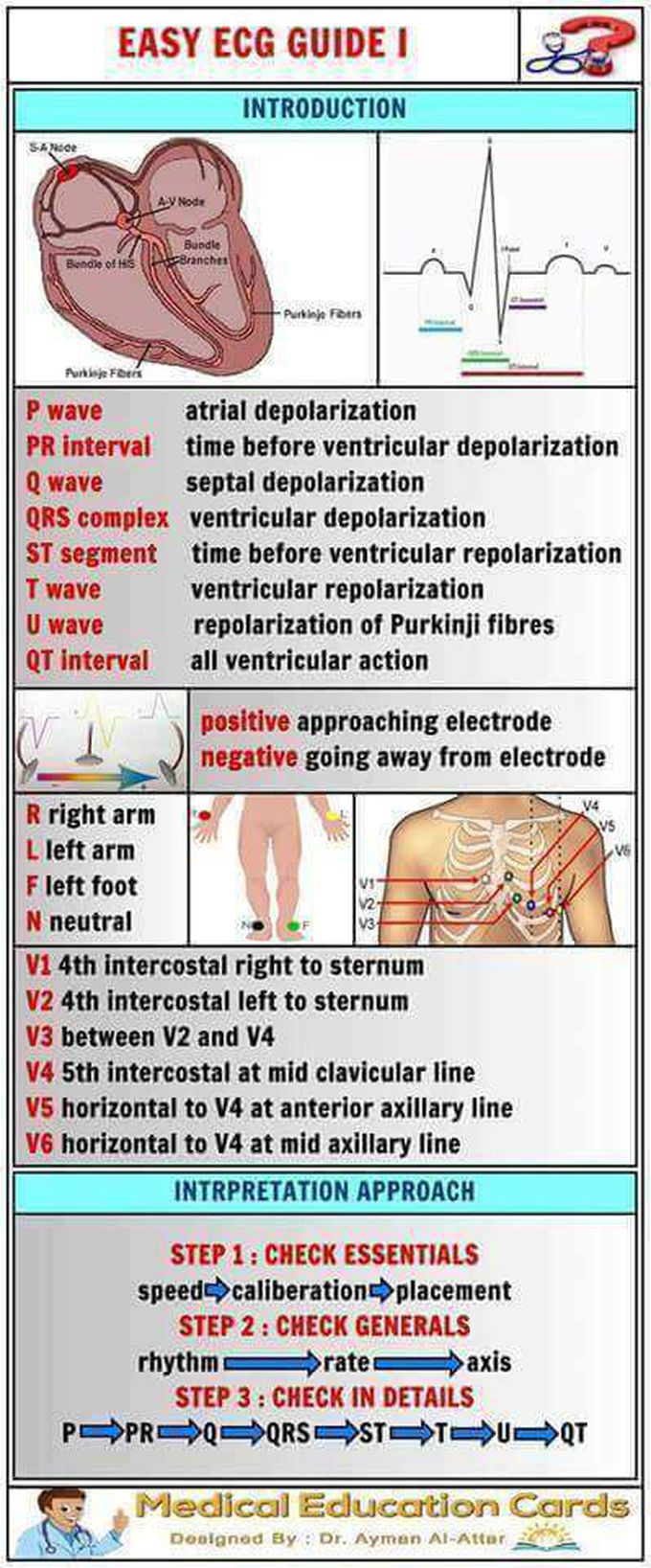 ECG