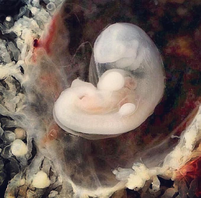 3-4 weeks embryo