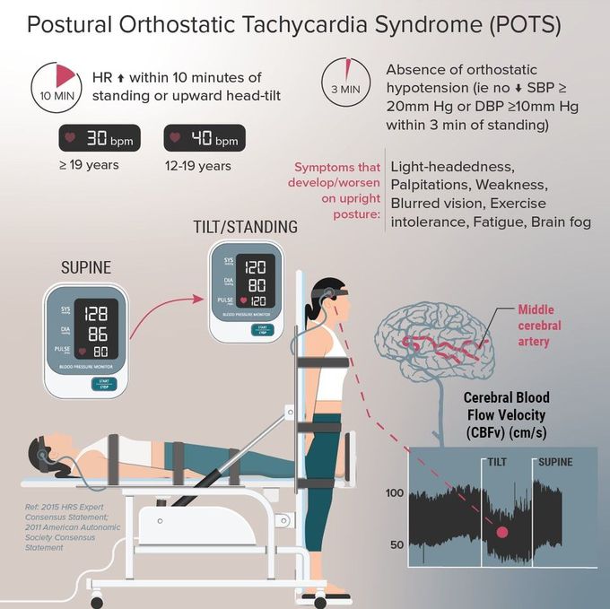 Postural orthostatic tachycardia syndrome (POTS)