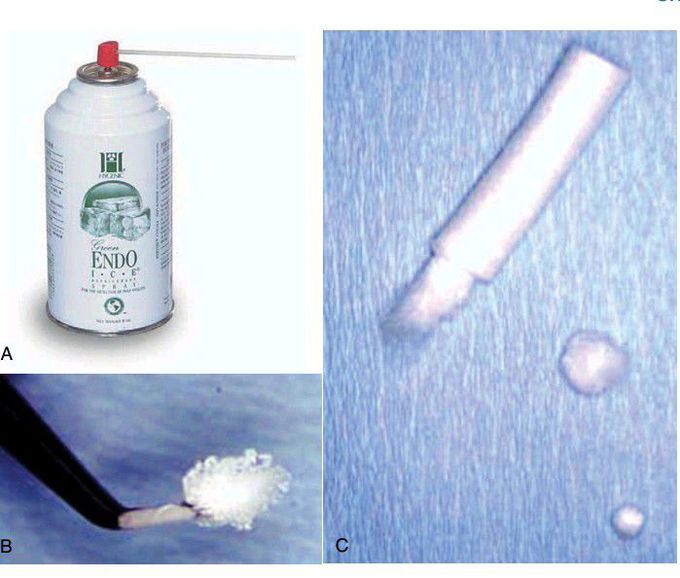 Cold test for pulp vitality