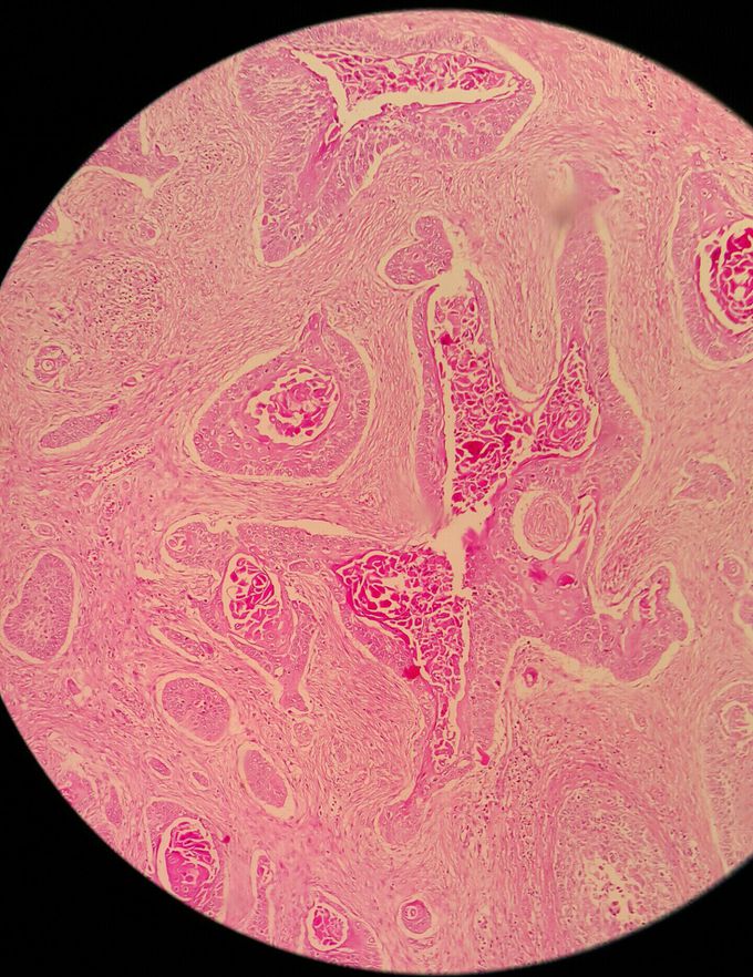🔻Pathology quiz🔻