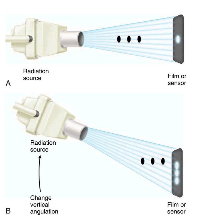 Radiographs in dentistry