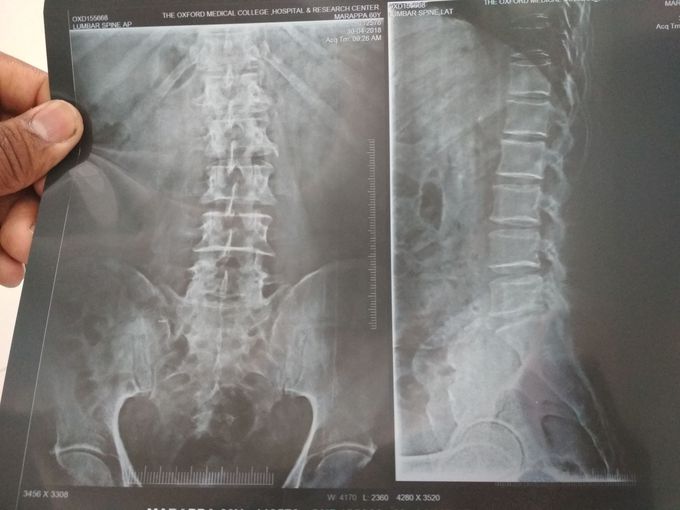 What are your diagnosis??