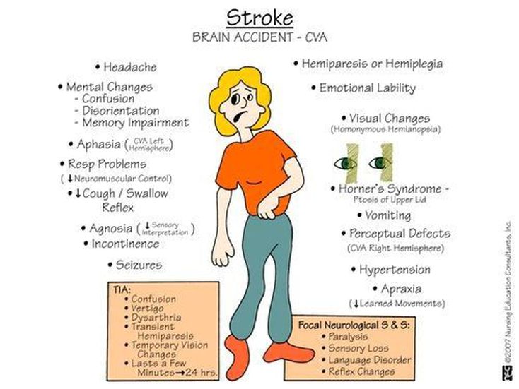 Stroke - MEDizzy