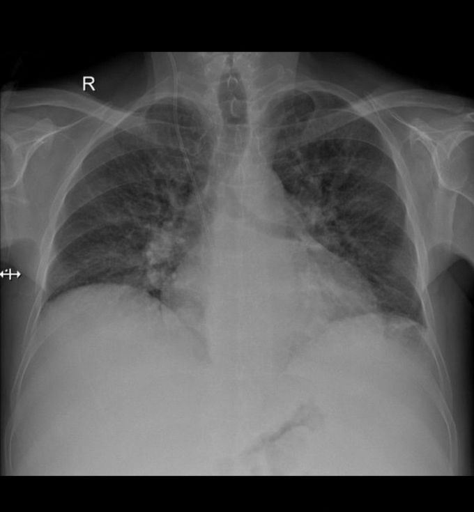 Diagnos?