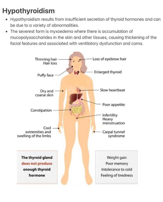 Hypothyroidism I