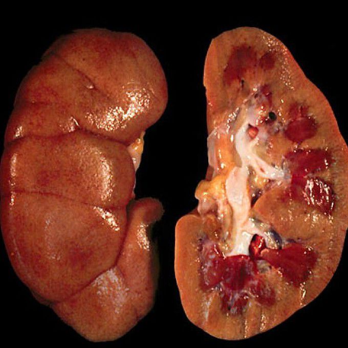 Shock kidney!
