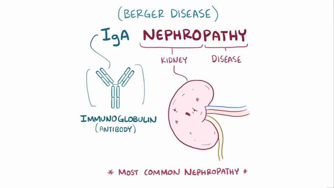 Iga Nephropathy Medizzy