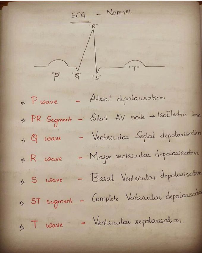 ECG