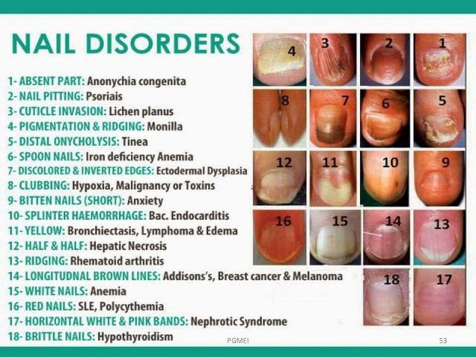 # nail disorders #in glance # easy