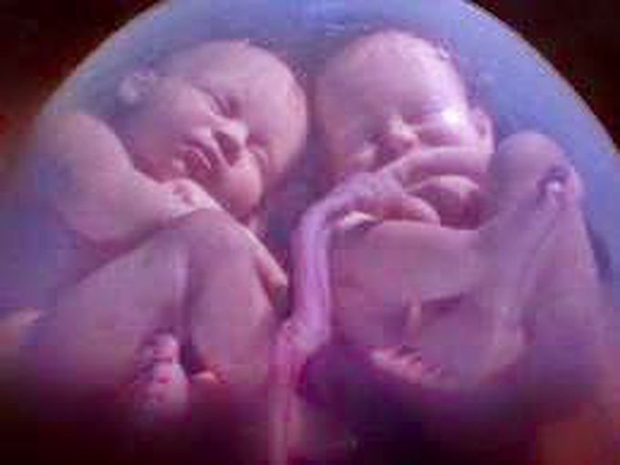 Foetus / Pregnancy