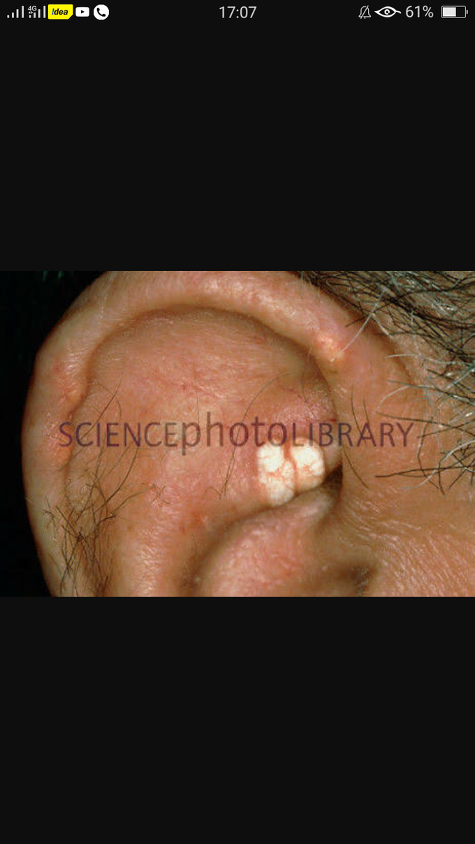 Diagnosis?
