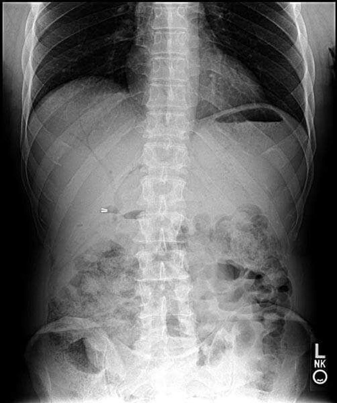 Diagnosis?