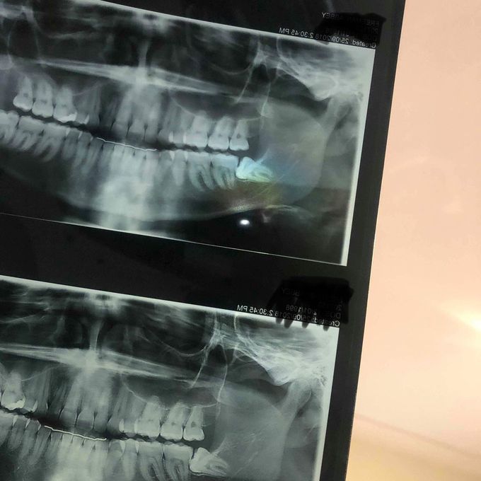 Diagnosis and treatment?