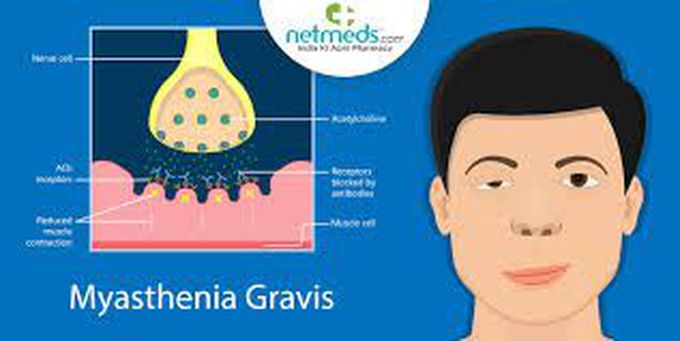 Myasthenia gravis causes