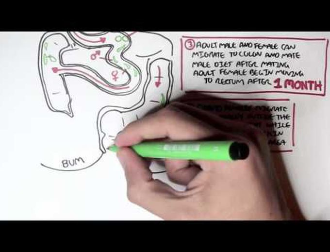 Pin Worms - Enterobius Vermicularis