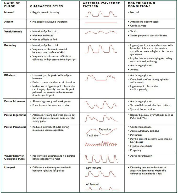 Pulse types..... MEDizzy