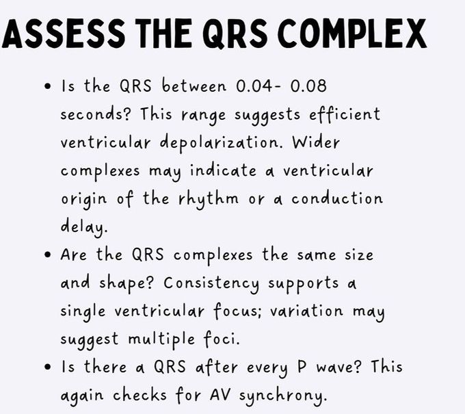 How to Read ECG- V