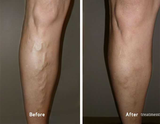 What's your diagnosis?and what are the causes and treatment of it?