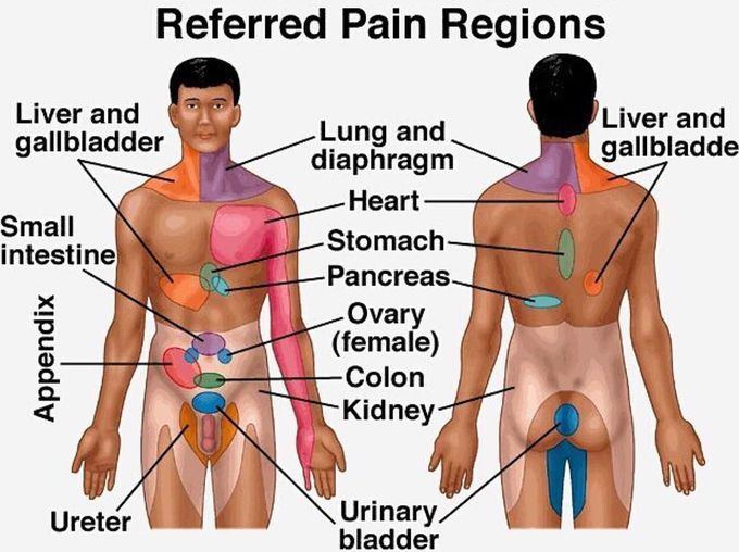 Referred Pain