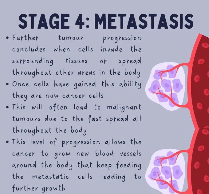 Tumor Progression Stage 3