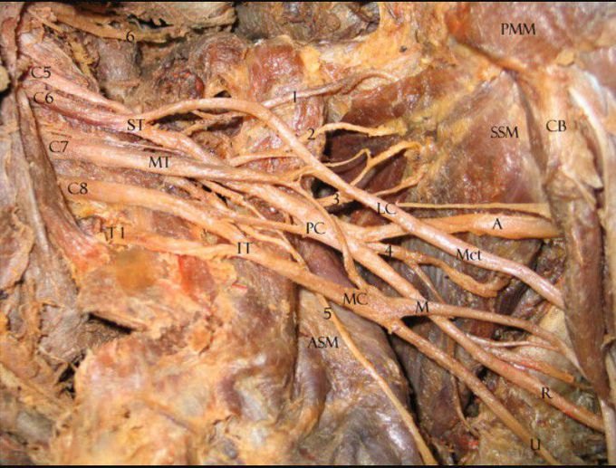 Brachial plexus