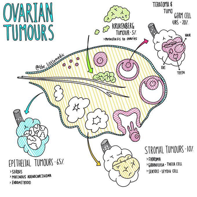 Ovarian Tumours