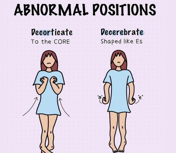 Abnormal Positions