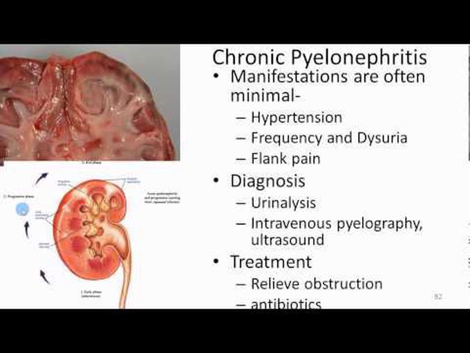 Lecture on major kidney diseases