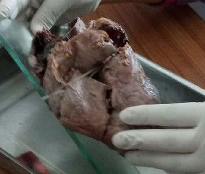 Anatomy